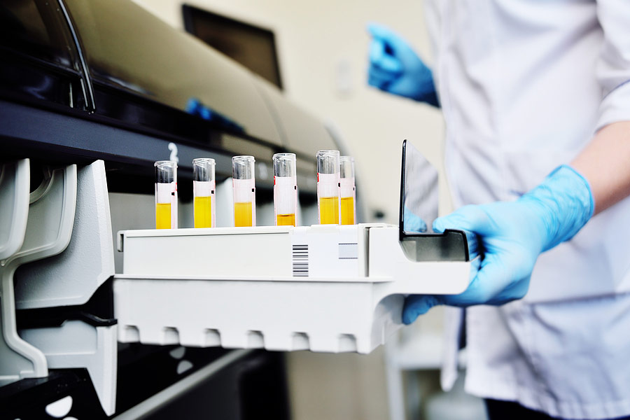 Molecular Urine Analysis